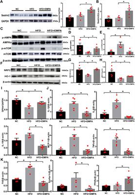 Empagliflozin activates Sestrin2-mediated AMPK/mTOR pathway and ameliorates lipid accumulation in obesity-related nonalcoholic fatty liver disease